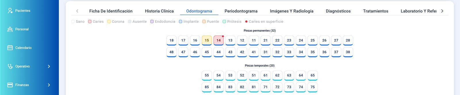 Odontograma digital del expediente clínico dental